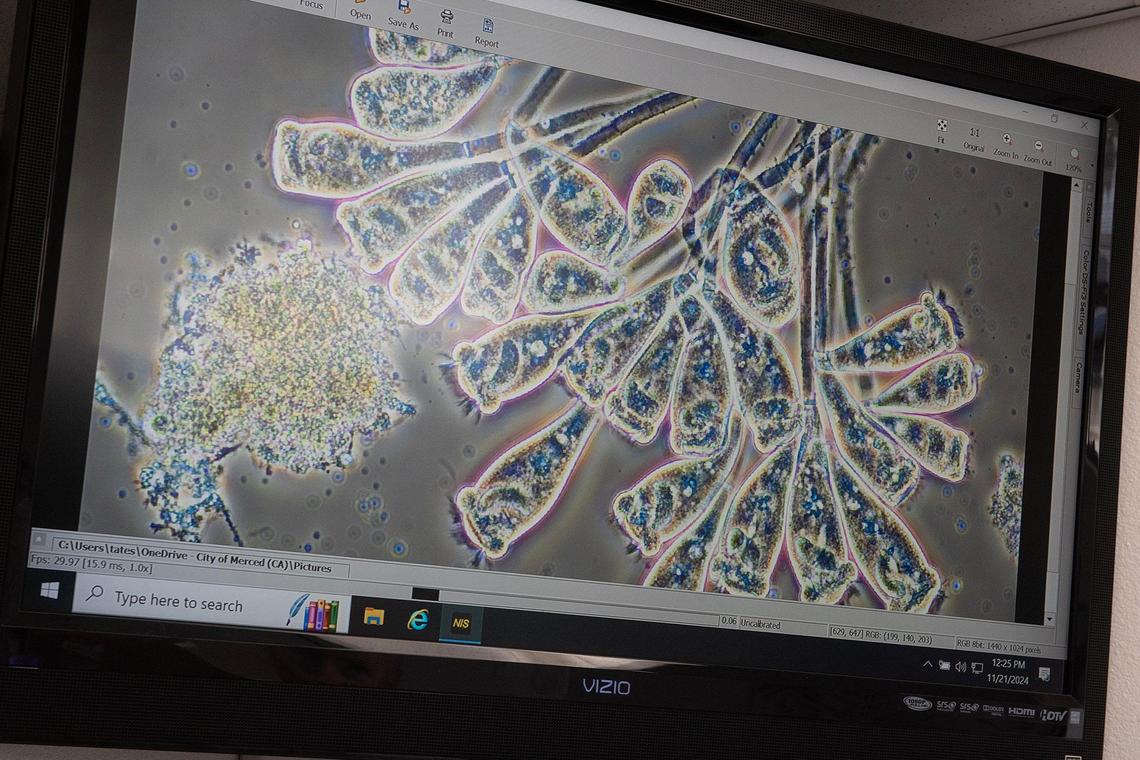 Microorganisms inside water samples are seen with the use of a microscope at the Wastewater Treatment Plant in Merced, Calif., on Thursday, Nov. 21, 2024.