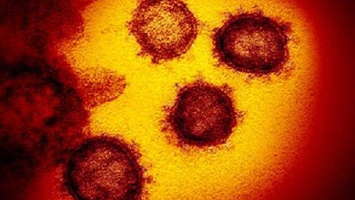 This transmission electron microscope image shows SARS-CoV-2, also known as 2019-nCoV, the coronavirus virus that causes COVID-19. Courthouse Club Fitness in Salem, Oregon, faces a new $126,000 fine for refusing to close during the COVID pandemic, state officials say.