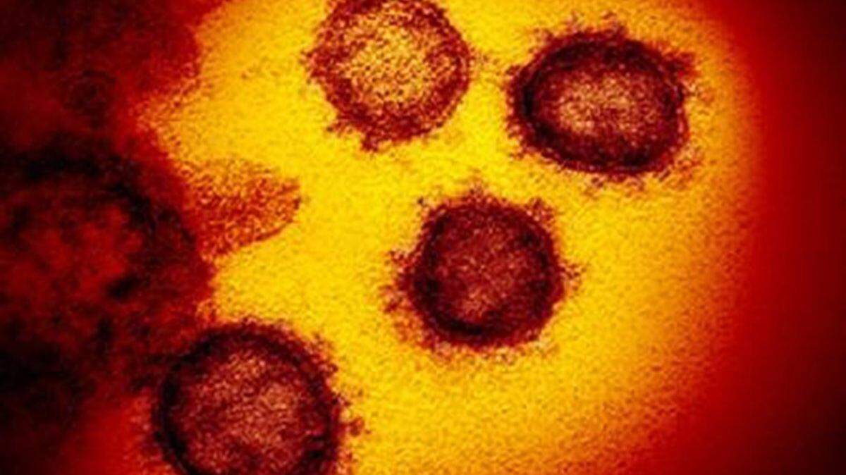 This transmission electron microscope image shows SARS-CoV-2, also known as 2019-nCoV, the coronavirus virus that causes COVID-19. Courthouse Club Fitness in Salem, Oregon, faces a new $126,000 fine for refusing to close during the COVID pandemic, state officials say.