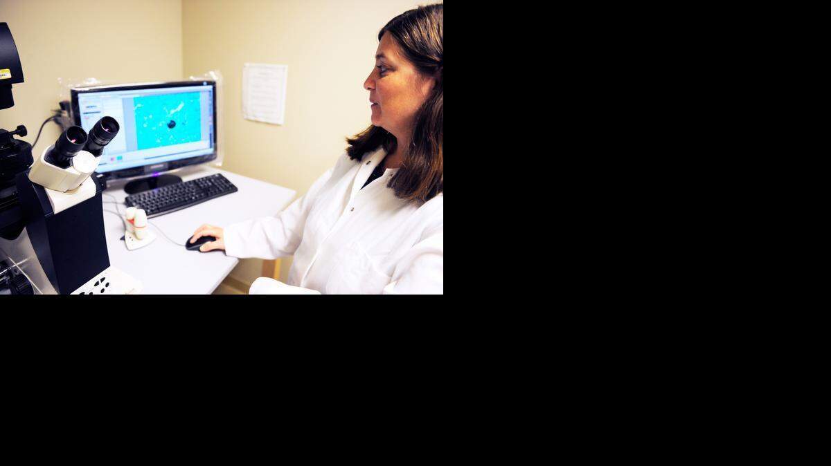 Researcher Katrina Hoyer looks at a picture of a spherule with endospores that has erupted and released the endospores into a lung and spread infection, in a biology lab at the UC Merced campus on Wednesday, July 30, 2014.
