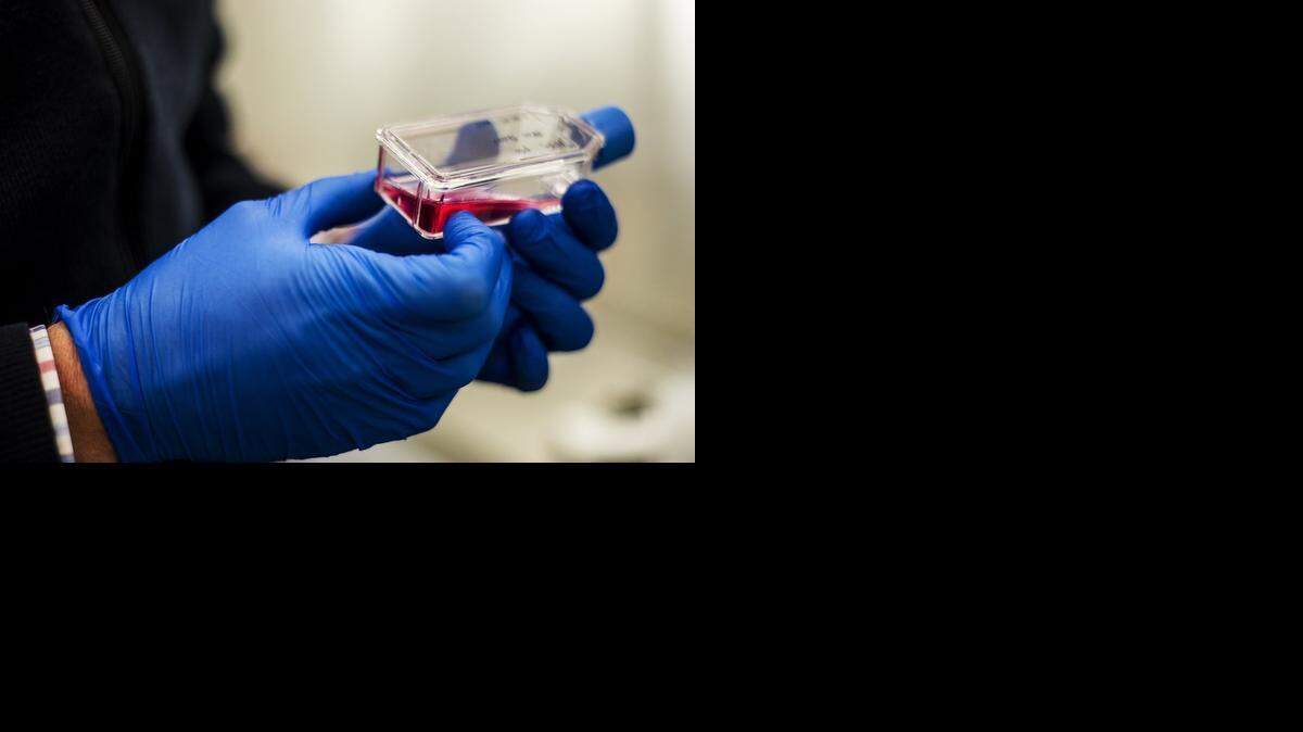 
UC assistant professor Kirk Jensen holds a flask containing human cells in a university lab. Exposure to the parasite that causes toxoplasmosis can result in serious health consequences, such as a congenital infection or lesions in the retina and brain. The parasites are most common in South America.

