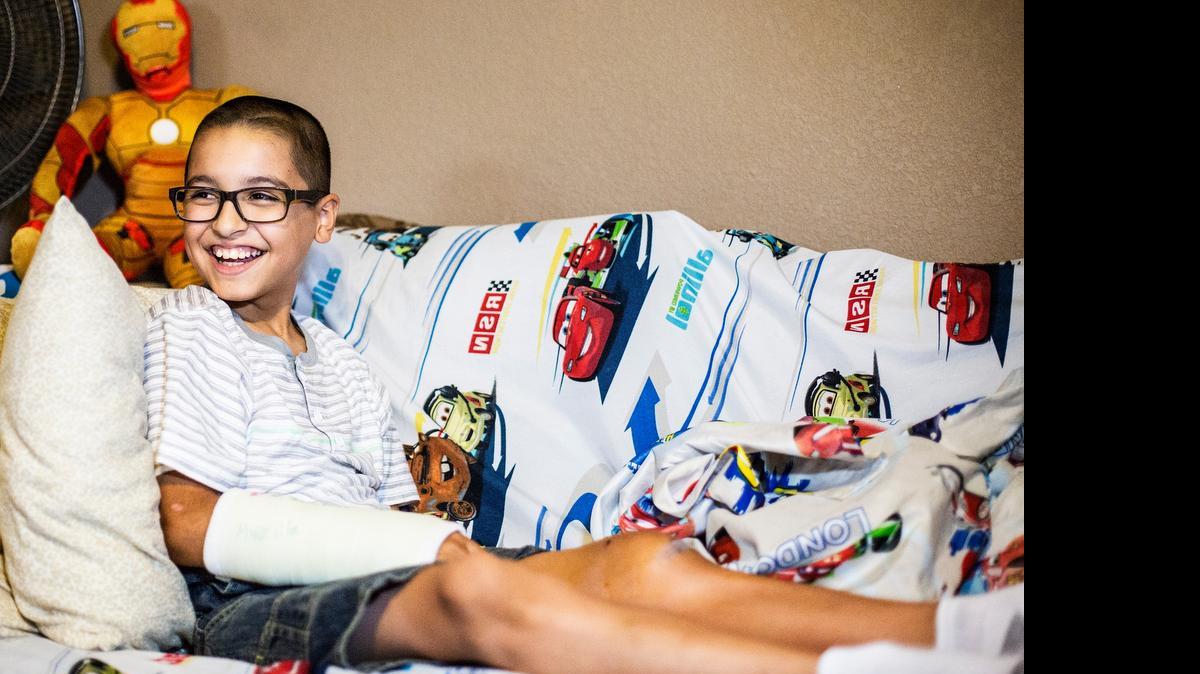 
Leo Serna, 10, of Merced laughs with his family while recuperating in the living room of their home in Merced on Friday. Serna is recovering after being struck by a stray bullet that went through his left leg and lodged into his right forearm, while watching fireworks with his family near Golden Valley High School on the Fourth of July.
