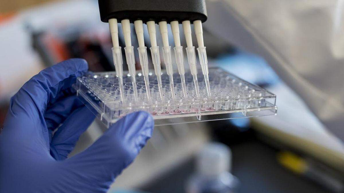University of California, Merced Professor of Systems Biology and Cancer Metabolism, Fabian Filipp, uses a multipipettor to transfer human tumor cells while explaining the process of High-throughput screening, a test to indicate which drugs and which regulators the cells respond to at the Science and Engineering Building 2 on the campus of UC Merced in Merced, Calif., on Thursday, March 2, 2017. Filipp is working to understand epigenetic mechanisms to develop precision targeting of cancer cells for personalized medicine.