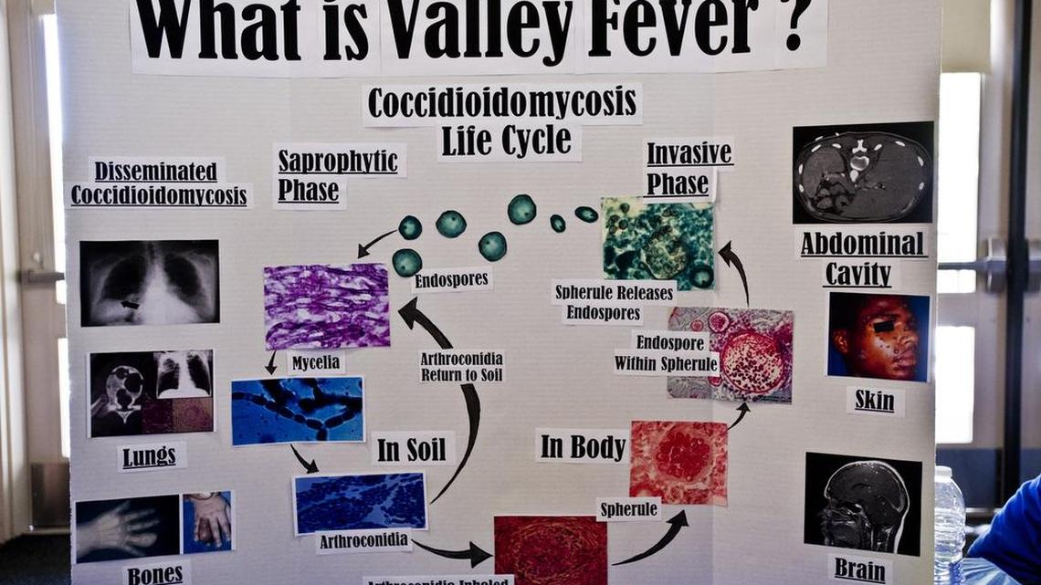If you have a cough it might not be the flu. Valley fever cases on the rise in Merced County, data shows
