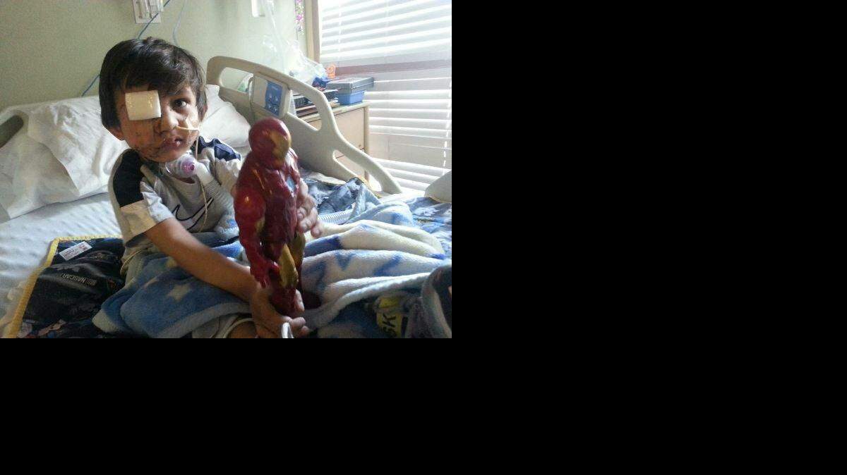 
 Four-year-old Kevin Vicente is shown in February after he was mauled by a pit bull in Arizona. Doctors said then that the attack had left the boy unable to swallow properly or open one eye. They said Kevin faced months, if not years, of reconstructive surgery.
